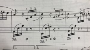 ピアノ発表会で エリーゼのために を美しく弾くためにはどうすればよいでしょうか 鍵盤の旅人